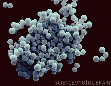 Electron micrograph of Staphylococcus epidermidis