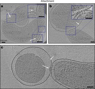 Cryo-ET images of Bdellovibrio infecting E. coli minicell