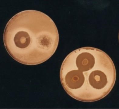 Antibiotic inhibition zones on agar plates