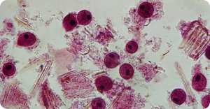 Amoeboid protozoa using pseudopods