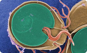 Ciliated protozoa