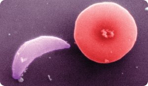 Flagellated protozoa