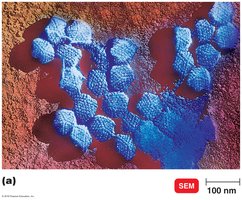 Electron micrograph of a polyhedral virus