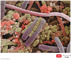 Normal microbiota on the human tongue