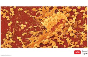 Biofilm on a catheter