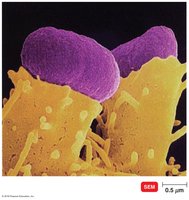 Pedestal formation by Enterohemorrhagic E. coli (EHEC) O157:H7