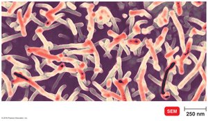 Ebola hemorrhagic virus