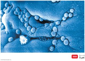 Cryptosporidiosis: oocyst in intestinal mucosa