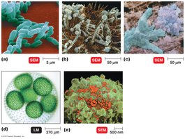 Types of microorganisms: bacteria, fungi, protozoa, algae, viruses, multicellular parasites
