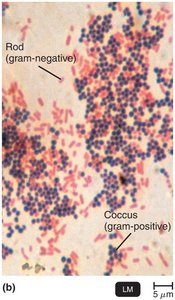 Gram stain results: gram-positive and gram-negative bacteria