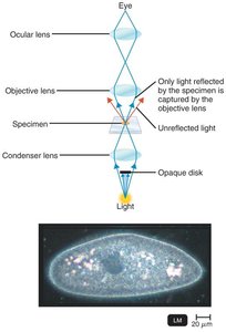 Darkfield illumination and specimen image