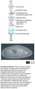 Phase-contrast illumination and specimen image