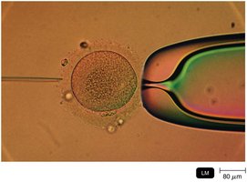 Microinjection of foreign DNA into an egg