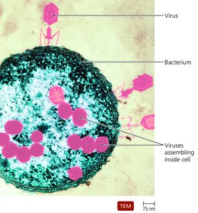 TEM of viruses infecting a bacterium