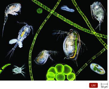 Microscopic view of diverse microorganisms