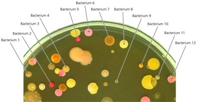 Petri dish with diverse bacterial colonies