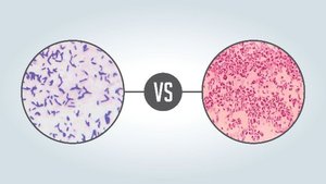 Gram stain comparison: positive vs negative