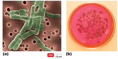 Filtration method for counting bacteria