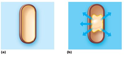 Bacterial cell in isotonic and hypertonic solutions