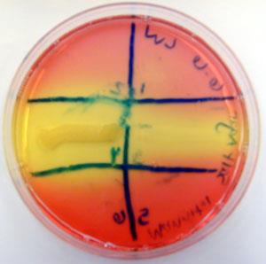 Mannitol Salt Agar plate