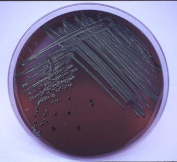 Eosin Methylene Blue Agar plate