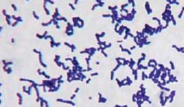 Gram-positive cell wall structure