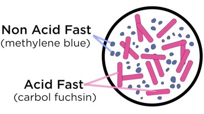 Acid-fast vs. non-acid-fast staining