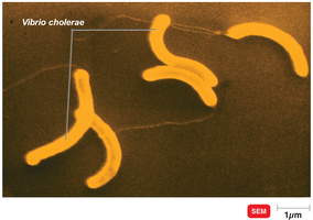 Vibrio cholerae under scanning electron microscope