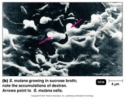 S. mutans growing in sucrose broth with dextran accumulations