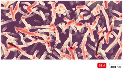 Ebola virus under electron microscope