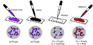Steps of Gram staining