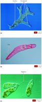 Locomotive structures of protozoa: pseudopods, cilia, flagella