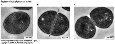 Septation in Staphylococcus aureus