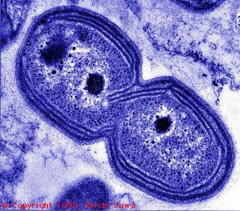 Electron micrograph of binary fission