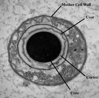 Electron micrograph of bacterial endospore