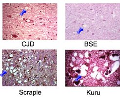 Histological images of prion diseases