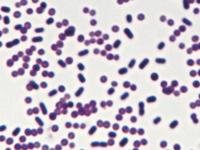 Comparison of types of microscopes