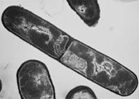 TEM image