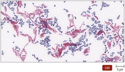 Ziehl-Neelsen acid-fast stain