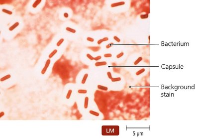 Negative (capsule) stain of Klebsiella pneumoniae