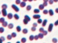 Gram stain image