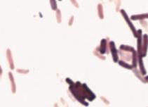 Acid-fast stain image