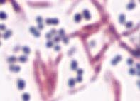 Endospore stain image