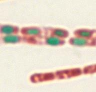 Negative stain image