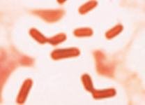 Capsule stain image