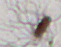 Flagella stain image