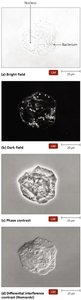 Four kinds of light microscopy: bright field, dark field, phase contrast, differential interference contrast