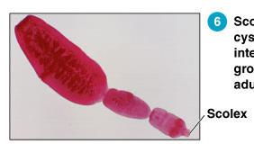 Parasitic flatworm (helminth) scolex
