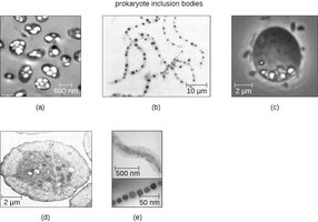 Prokaryotic inclusion bodies