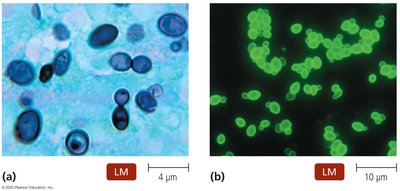 GMS stain of fungal cells
